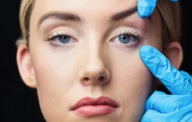 چگونه بهترین جراح بلفاروپلاستی را انتخاب کنیم؟