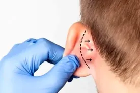 هزینه جراحی‌ گوش و افزایش قد چند؟