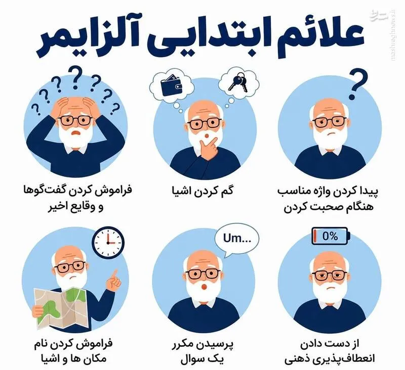آلزایمر