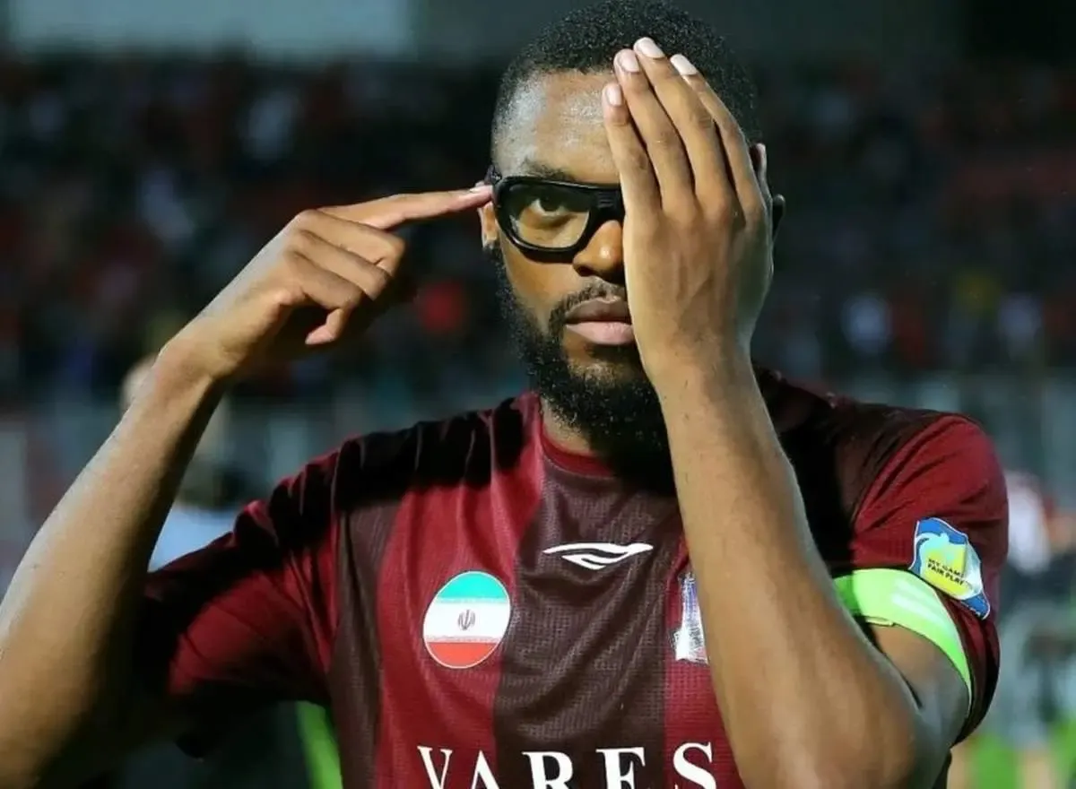 وضعیت ناراحت‌کننده چشم کوین یامگا / عکس