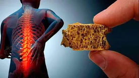 خوراکی‌هایی که از پوکی استخوان جلوگیری می‌کند