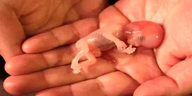 300 هزار سقط جنین غیرقانونی در ایران