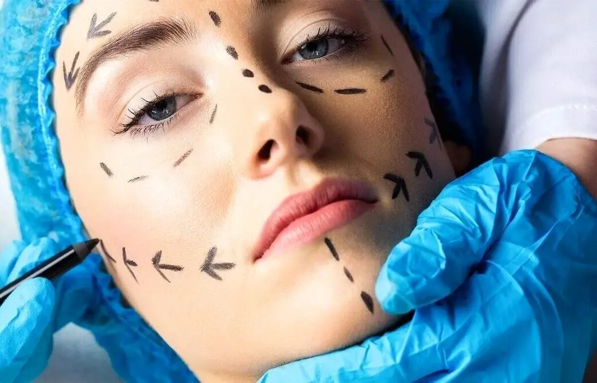 با سونامی عمل‌های زیبایی مواجهیم ؛ افزایش ۴۰ درصدی آمار جراحی زیبایی در دنیا !