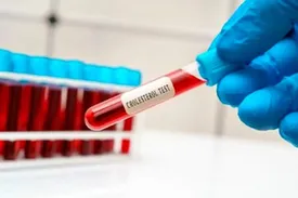 ۸ ماده غذایی مفید برای کسانی که کلسترول بالا دارند