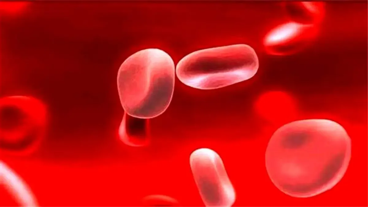 شایع‌ترین علائم کم‌خونی