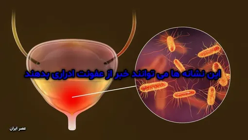 این نشانه‌ها می‌توانند خبر از عفونت ادراری بدهند