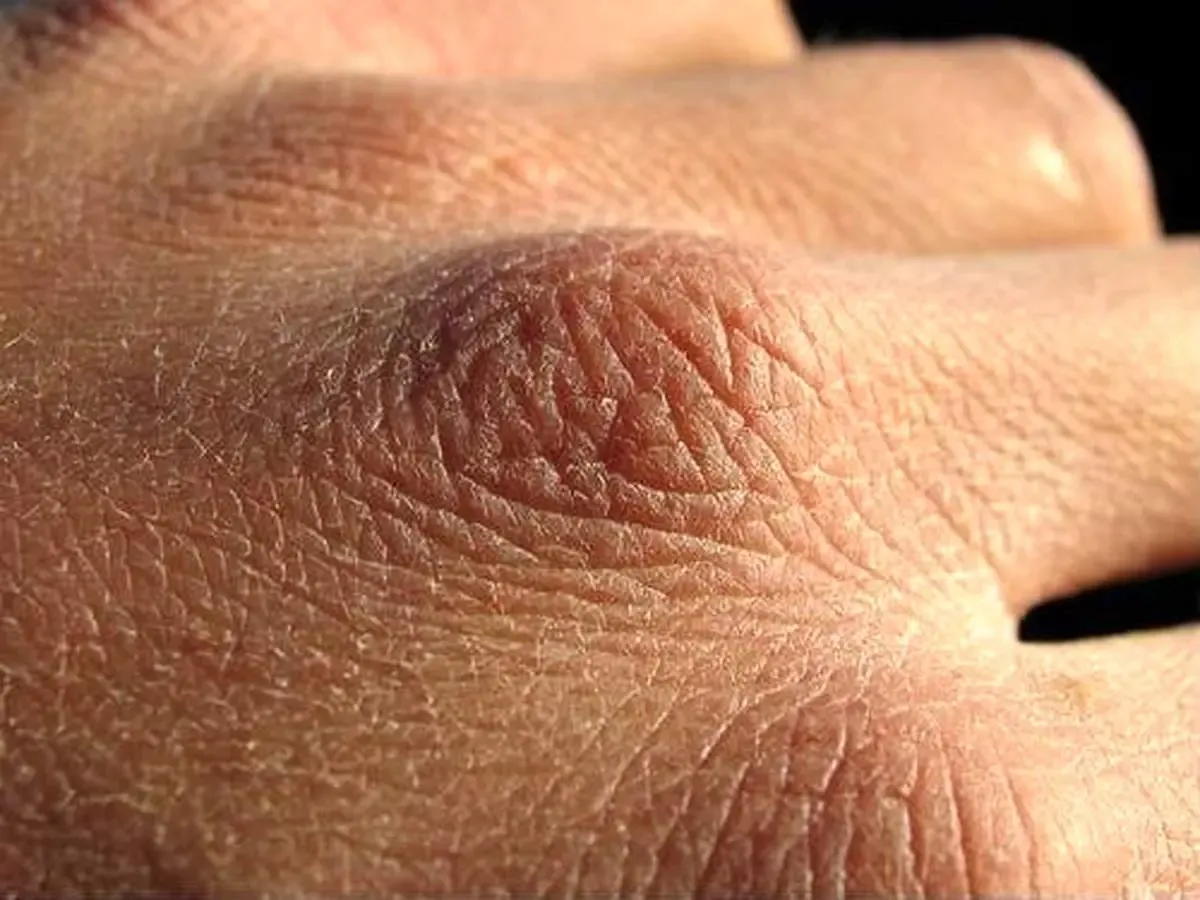 ۶ اثر «کلاژن» بر سلامت