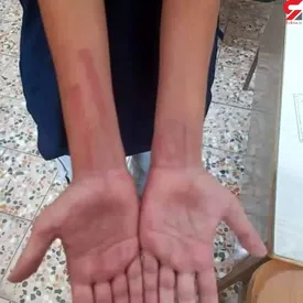 تنبیه یک دانش آموز دیگر/ این بار در ایذه