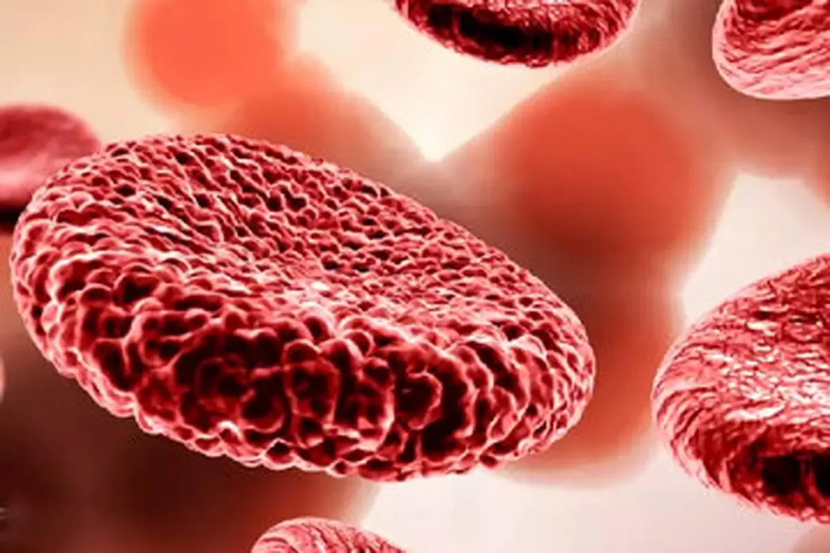 مهم‌ترین نشانه‌های کم خونی چیست و چه باید کرد؟