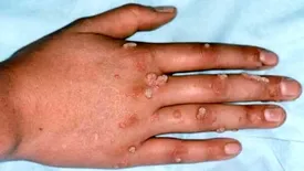 سرایت این بیماری خطرناک به آرایشگاه‌های زنانه؛ خانم های جوان مراقب باشند!