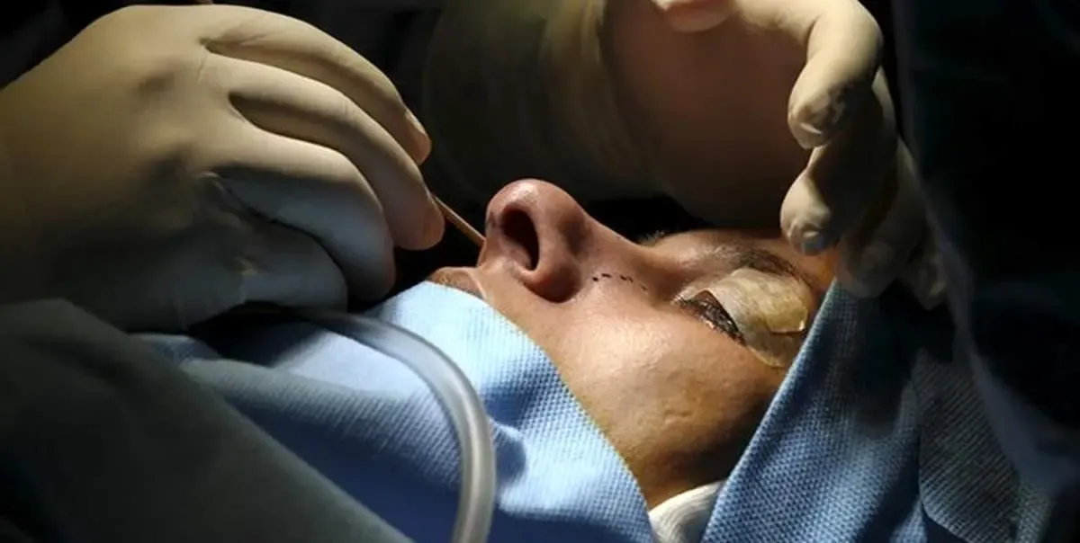 هشدار درباره فعالیت دلالان جراحی زیبایی