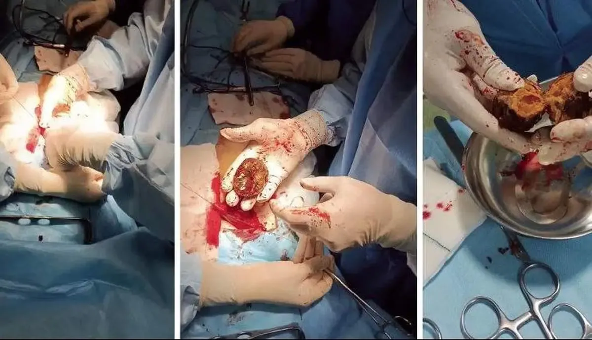 هشدار جدی؛ خرمالو با پوست و با انار نخورید