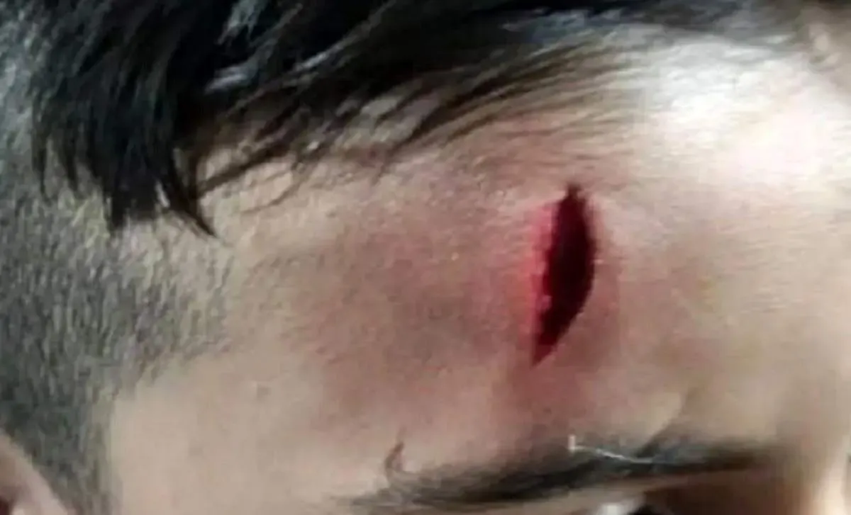 تصویر دانش آموزی که بدجور از معلم خود کتک خورد