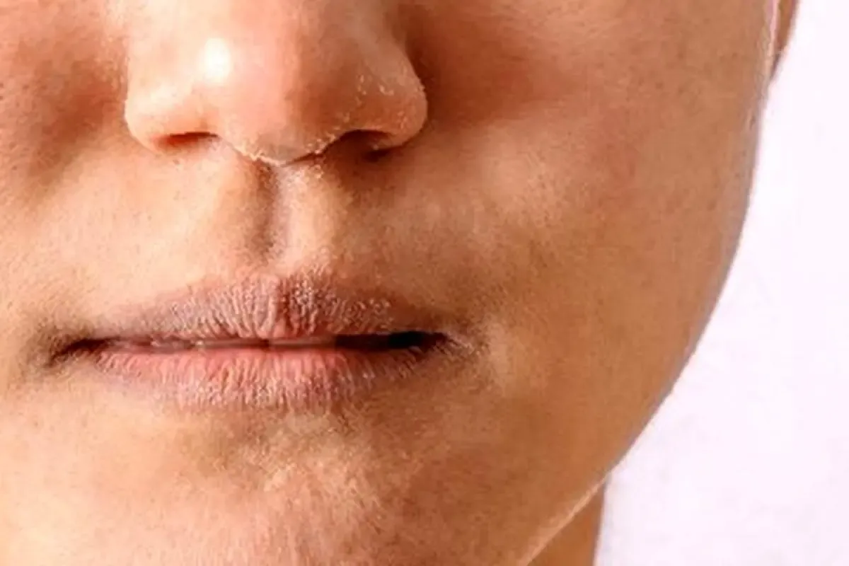 این گروه در سنین پایین پیر می‌شوند