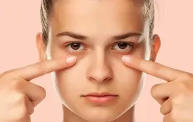 ۷ عادت ساده برای خداحافظی با پف زیر چشم