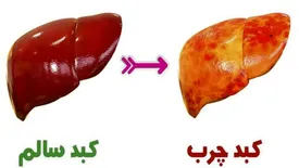 با این برنامه غذایی کبد چرب خود را کنترل کنید