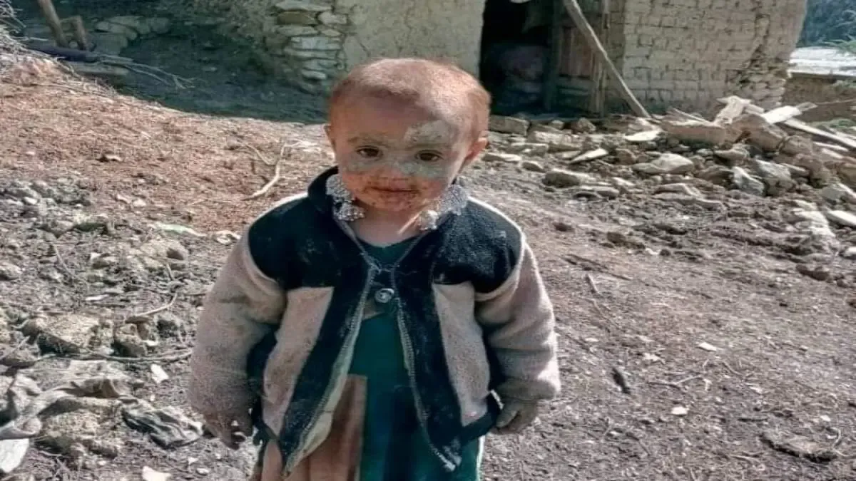 تلفات فاجعه بار زلزله افغانستان/  تاکنون ۲۰۵۳ نفر  مرده اند!/
کسی به فکر مردم افغانستان هست؟!