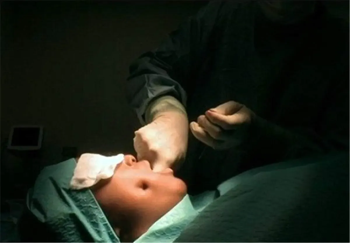 کلینیک های غیر مجاز ؛ جراحی زشتی یا زیبایی؟