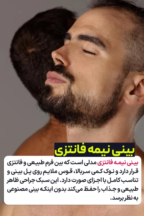 بینی نیمه فانتزی چیست ؟