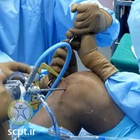 این ورزشکار تحت عمل جراحی قرار گرفت