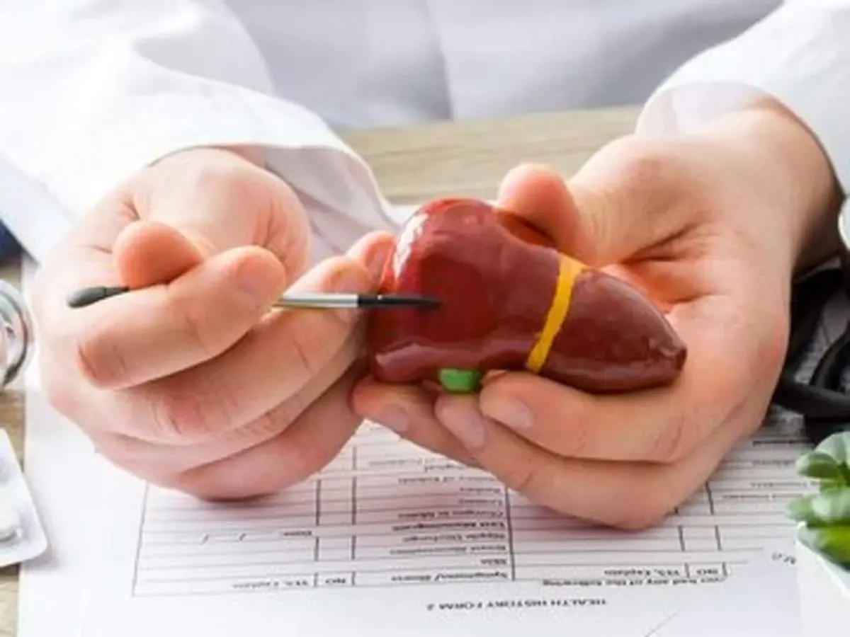 درمان اصلی کبد چرب چیست؟