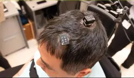 بازگشت حس به فرد ضایعه نخاعی با کمک ایمپلنت مغزی هوش‌مصنوعی