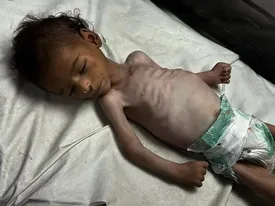 ​عکس هایی که جهانیان را شوکه کرد؛ شهادت نوزاد فلسطینی بر اثر گرسنگی/ تصاویر