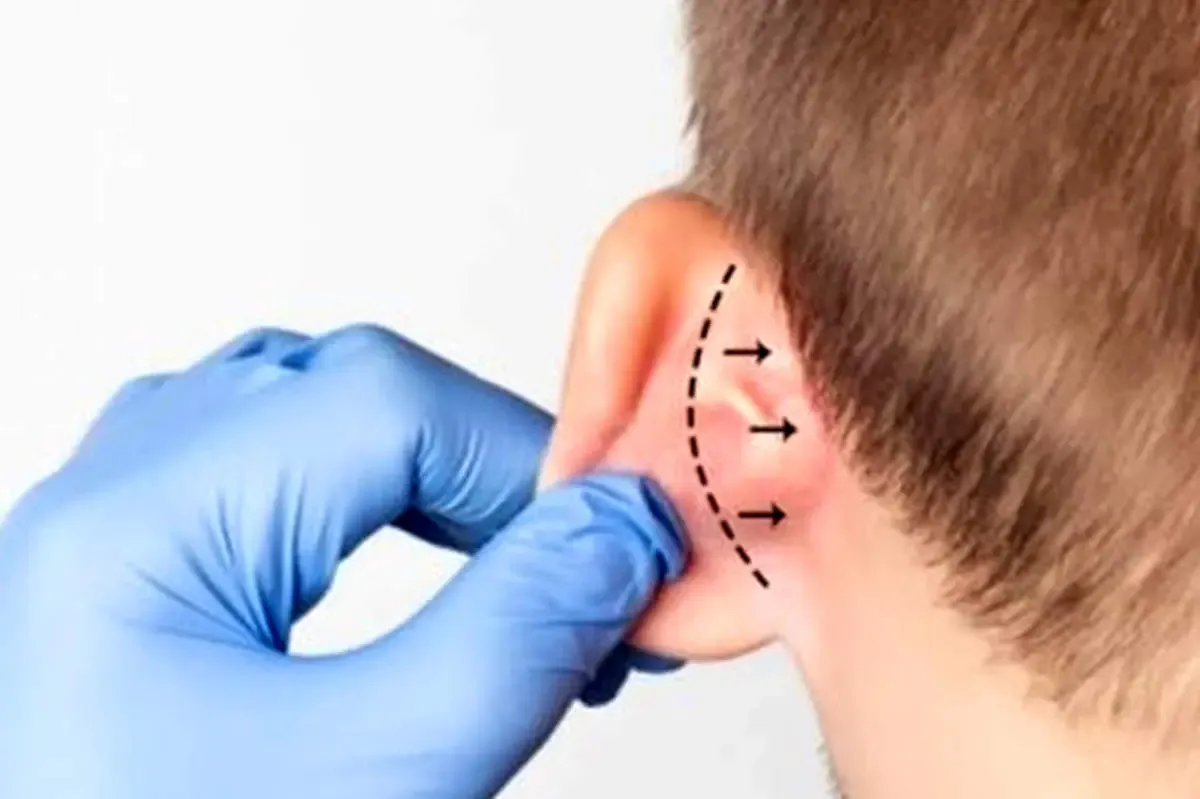 هزینه جراحی‌ گوش و افزایش قد چند؟