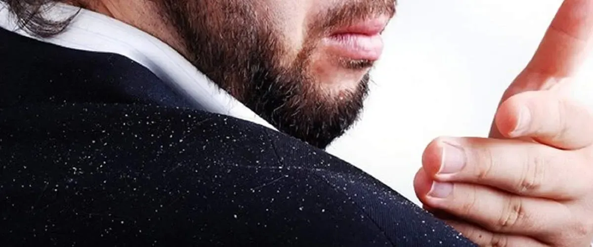 چگونه تغذیه بر شوره سر اثر می گذارد؟