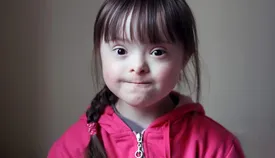 بیماران سندرم داون با این روش درمان می‌شوند