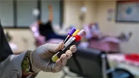 تفاوت شرایط اهدای خون در دوران کرونا/نیاز به خون همیشگی است