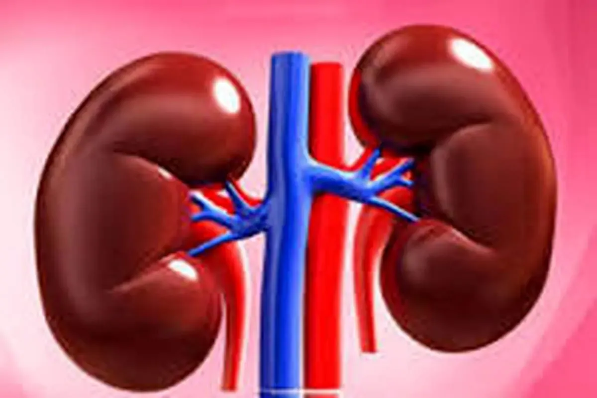 اینفوگرافیک/ ۸ عادت غلط که سبب بروز سنگ کلیه می‌شود